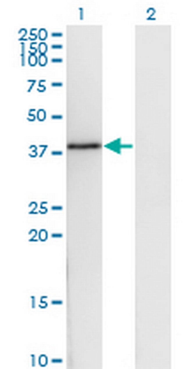 DNAJB6 Antibody in Western Blot (WB)