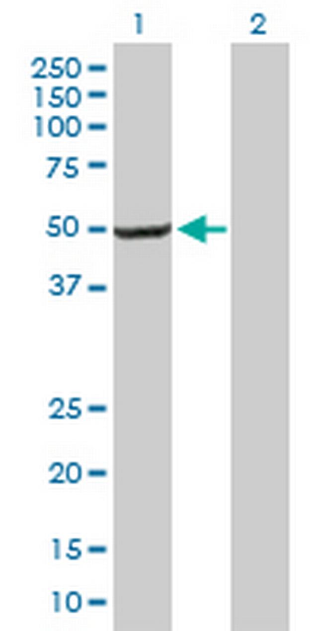 AP1M2 Antibody in Western Blot (WB)