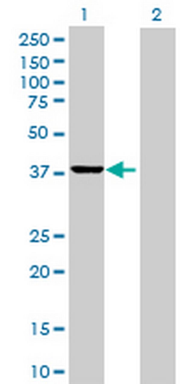 SAE1 Antibody in Western Blot (WB)