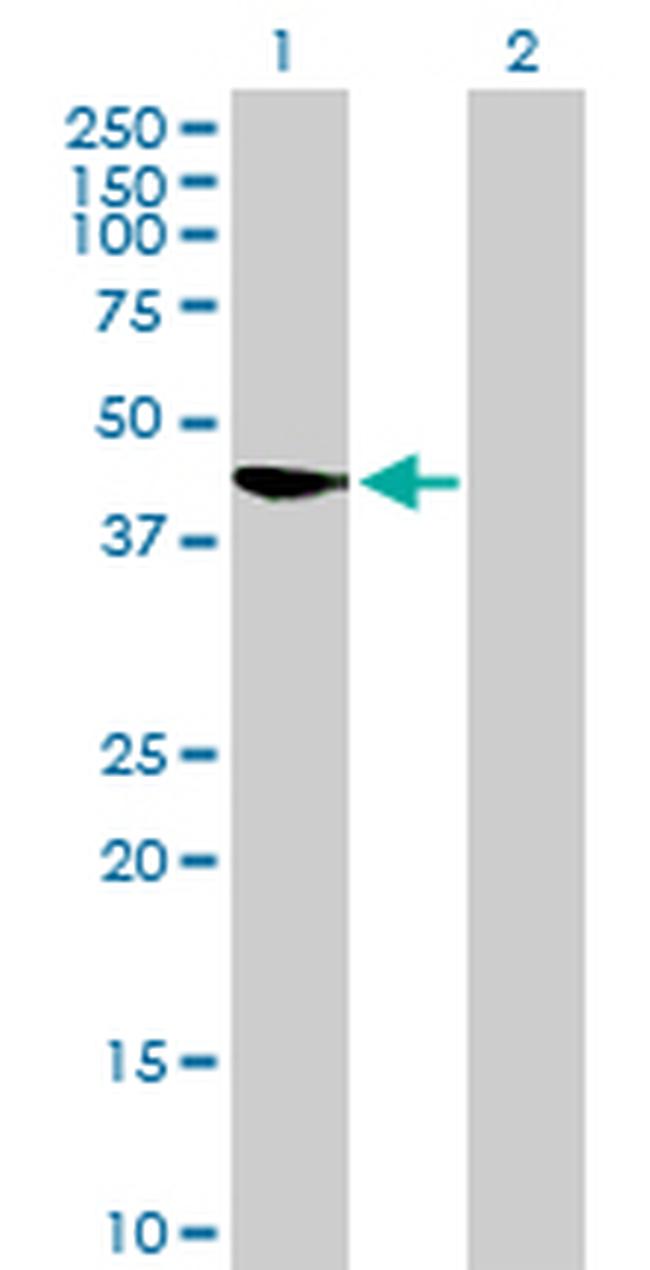 SAE1 Antibody in Western Blot (WB)