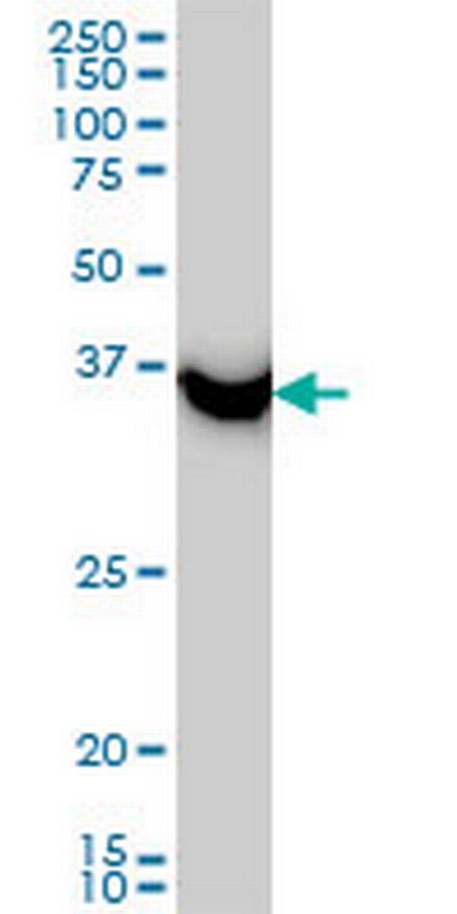 SAE1 Antibody in Western Blot (WB)