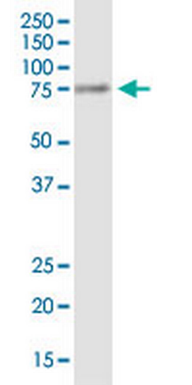 DNM1L Antibody in Western Blot (WB)