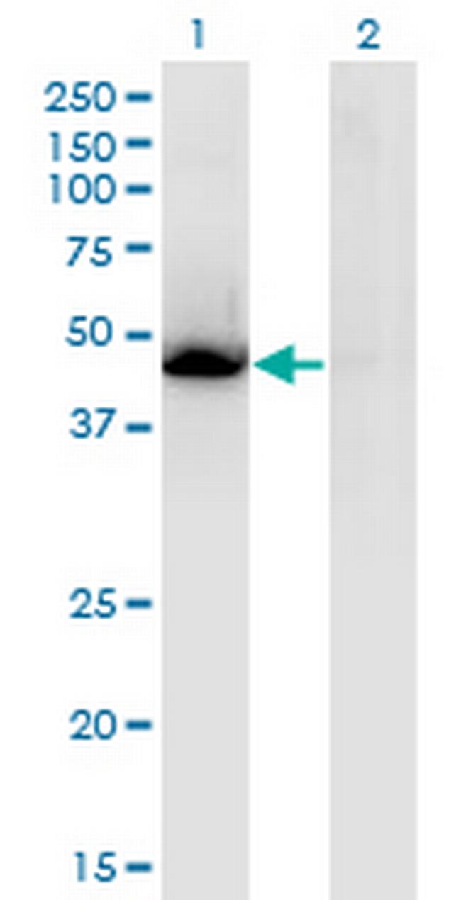 NR1H3 Antibody in Western Blot (WB)