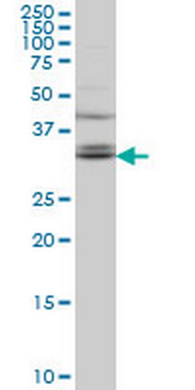 TSPAN32 Antibody in Western Blot (WB)
