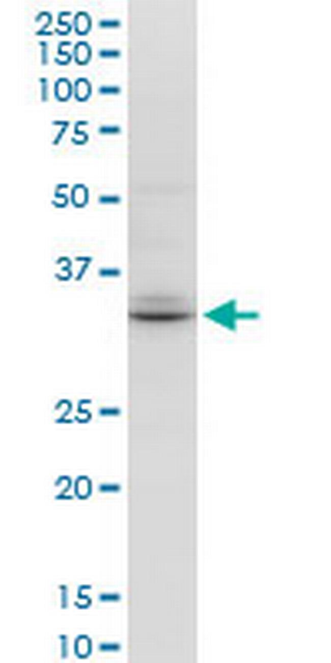 TSPAN32 Antibody in Western Blot (WB)