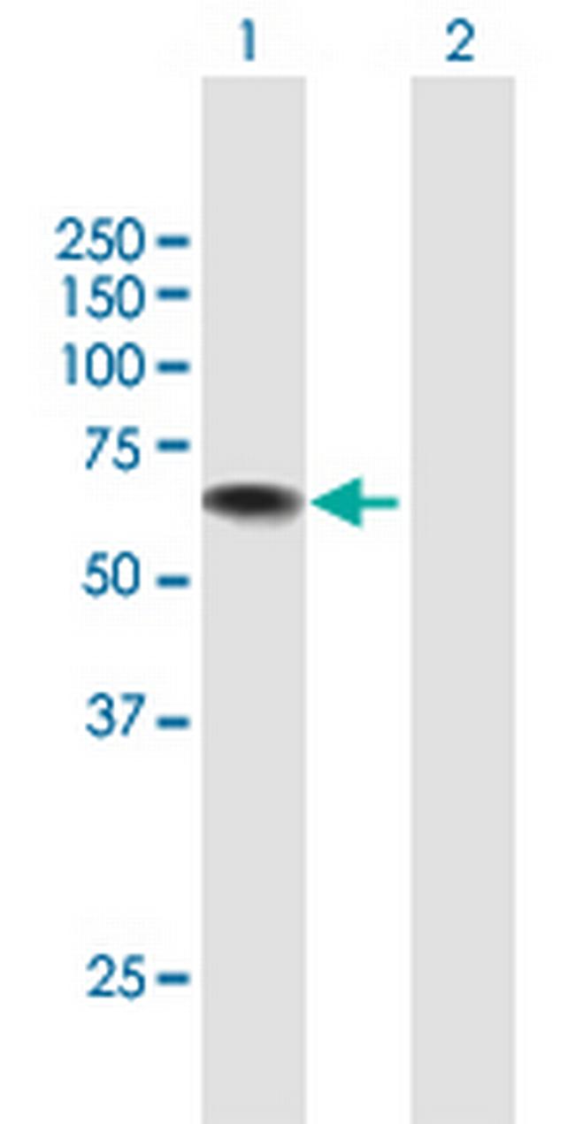 USH1C Antibody in Western Blot (WB)