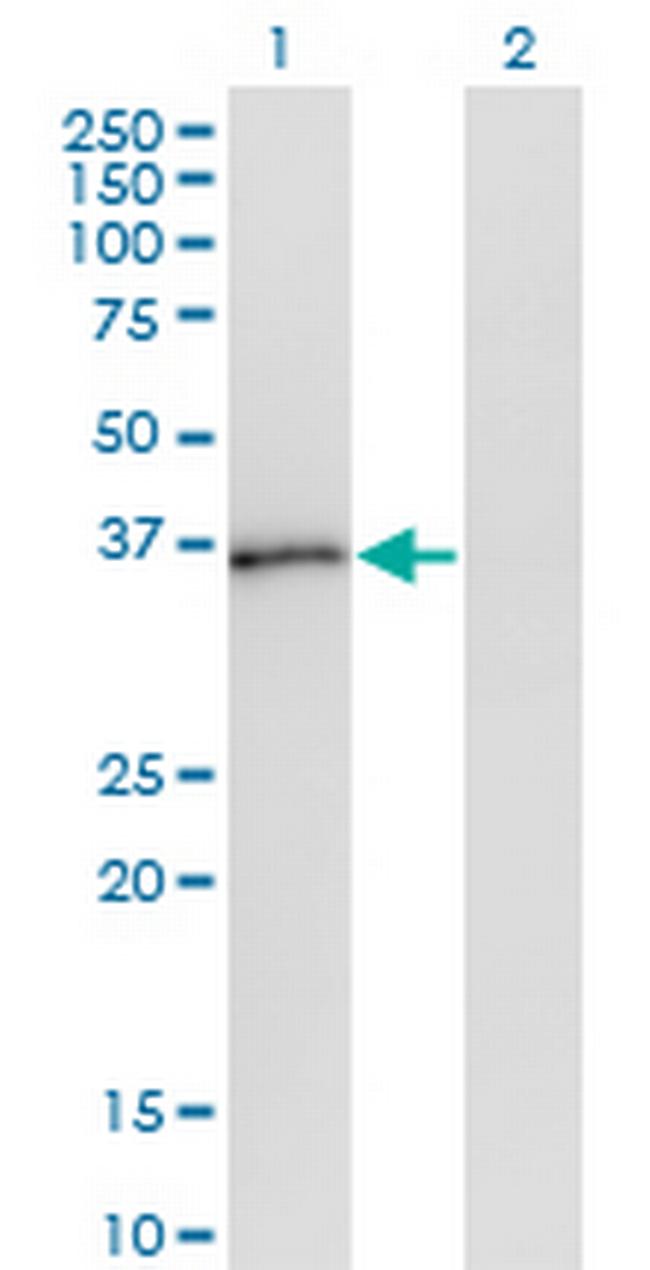 PQBP1 Antibody in Western Blot (WB)