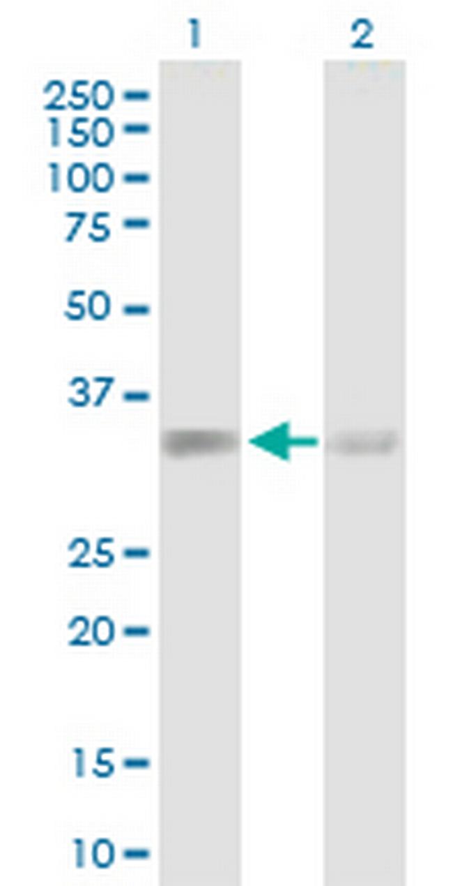 ACTR2 Antibody in Western Blot (WB)