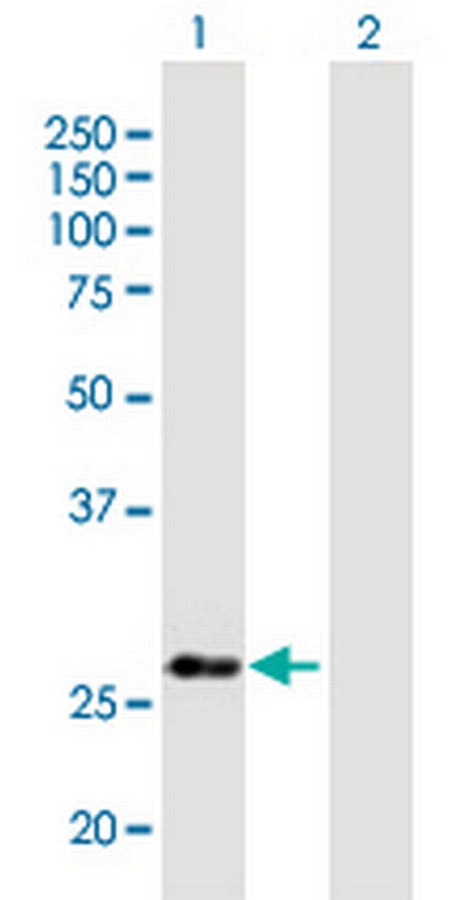 NUBP2 Antibody in Western Blot (WB)