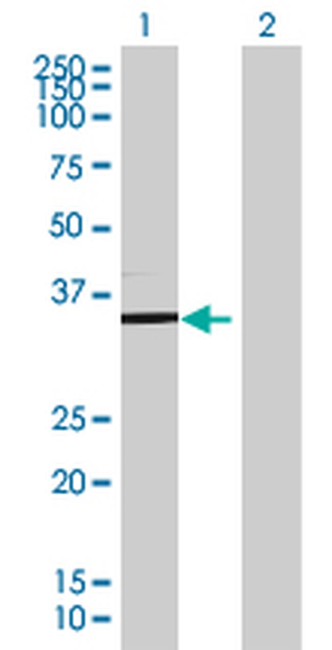 TSFM Antibody in Western Blot (WB)
