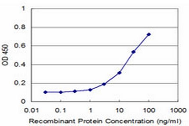 CTDSP2 Antibody in ELISA (ELISA)