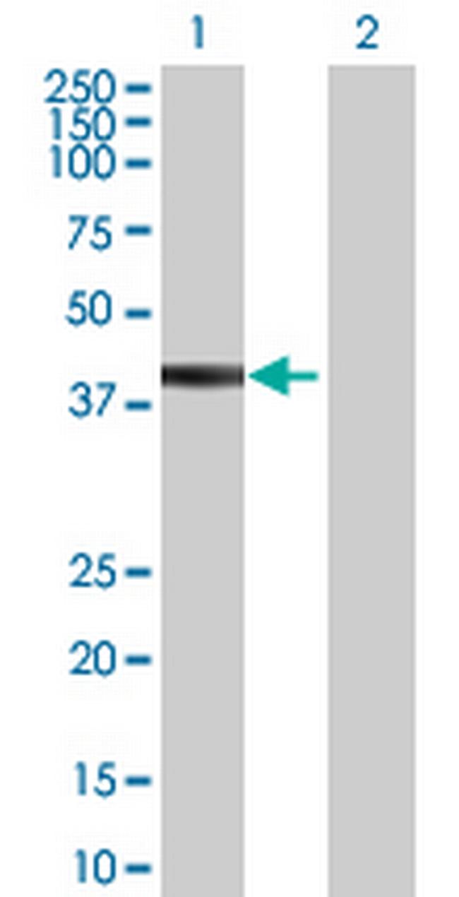 TRIM10 Antibody in Western Blot (WB)