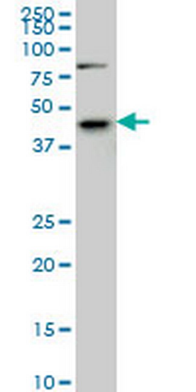 SGK2 Antibody in Western Blot (WB)