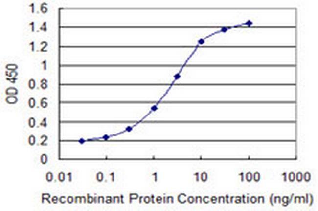 ENAM Antibody in ELISA (ELISA)