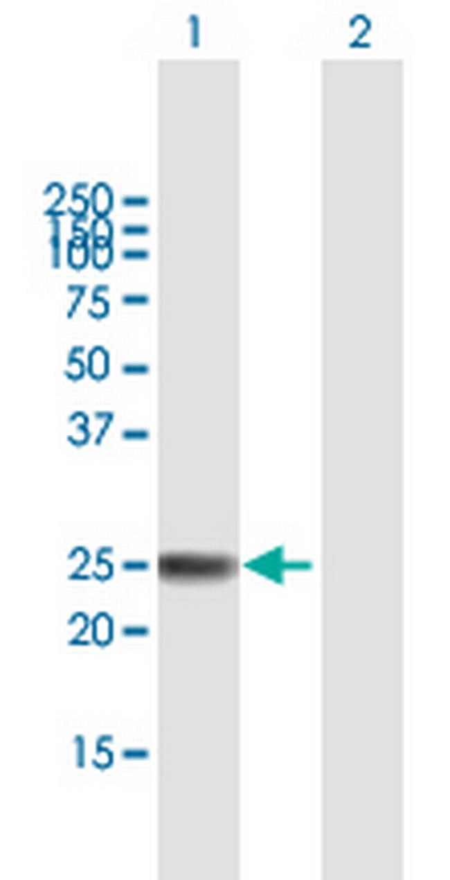 ARL4A Antibody in Western Blot (WB)
