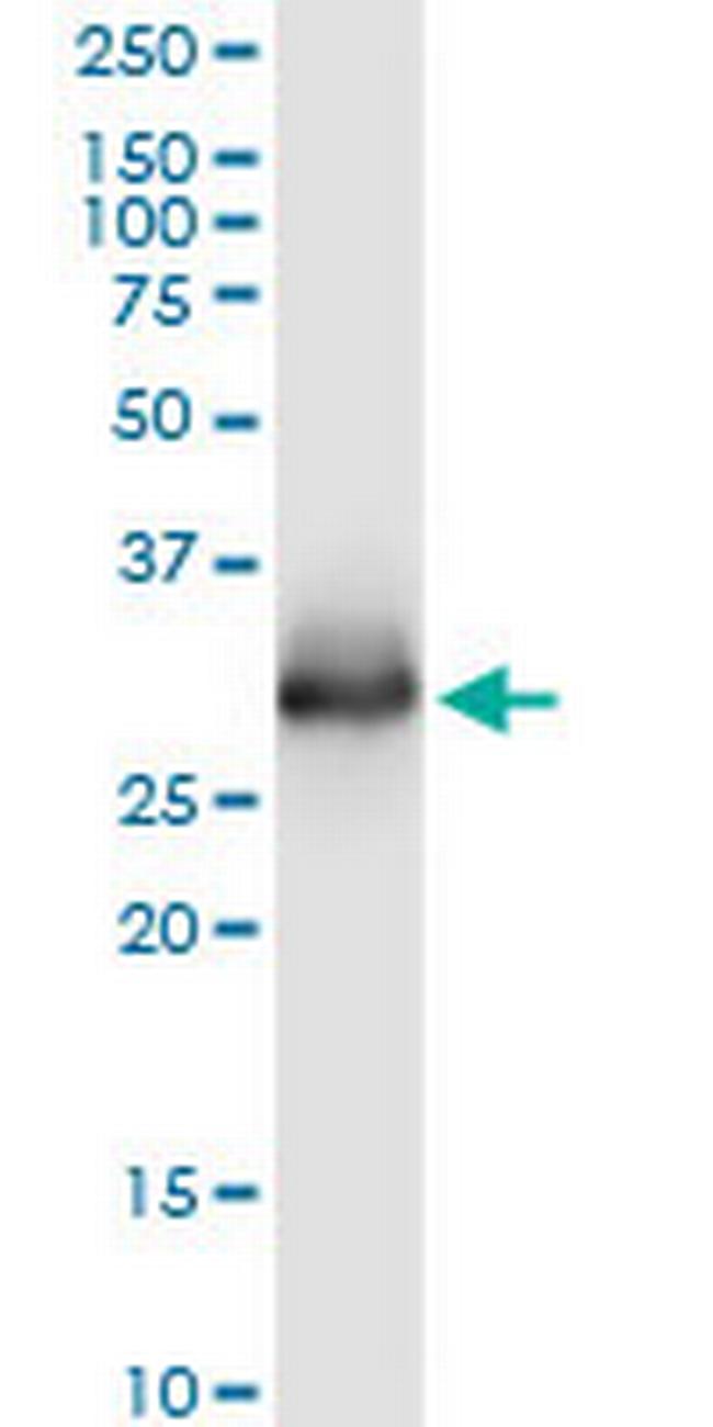 ELA3A Antibody in Western Blot (WB)