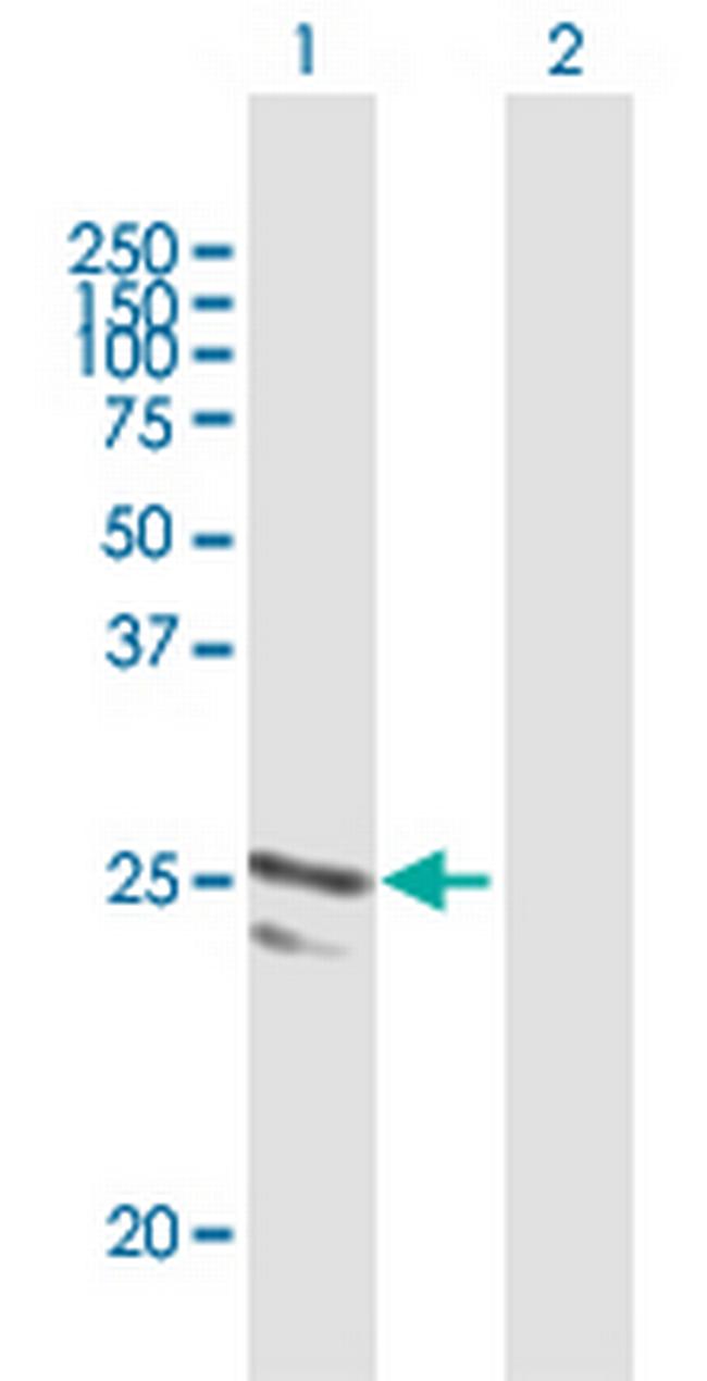ARFRP1 Antibody in Western Blot (WB)