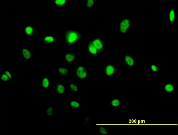 TOB1 Antibody in Immunocytochemistry (ICC/IF)