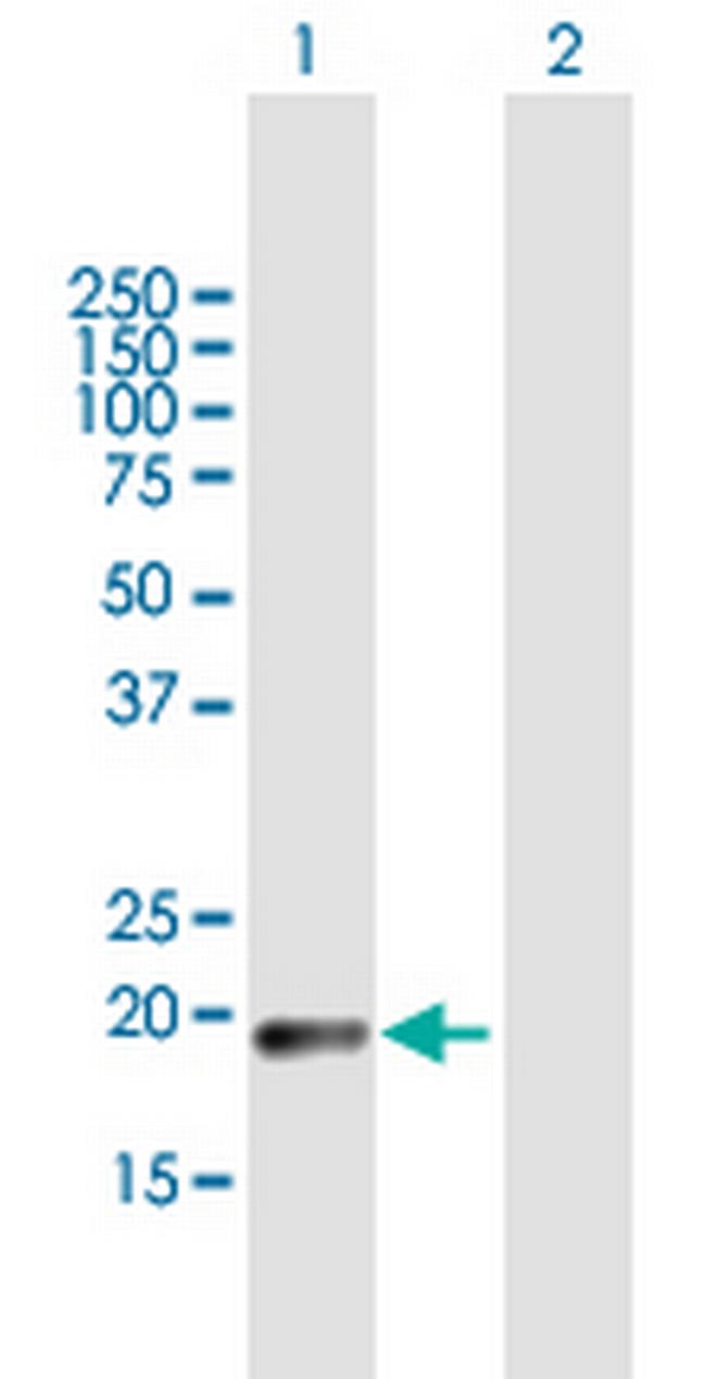CLEC3A Antibody in Western Blot (WB)