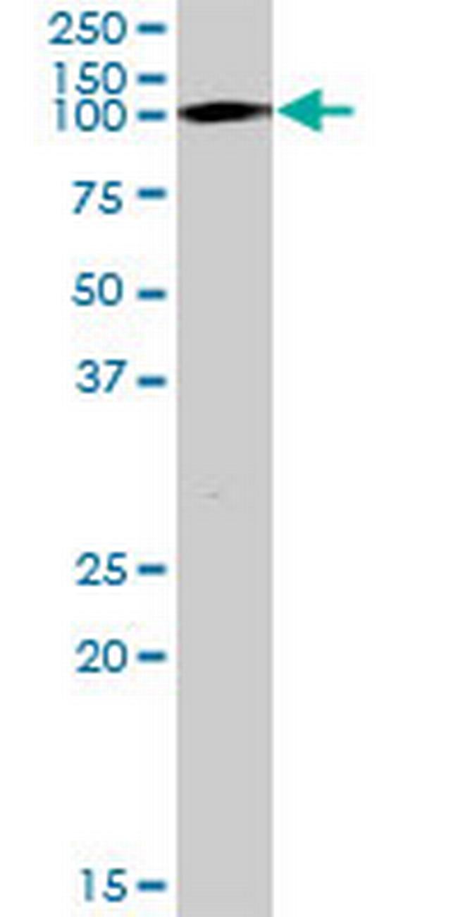 TRIM28 Antibody in Western Blot (WB)