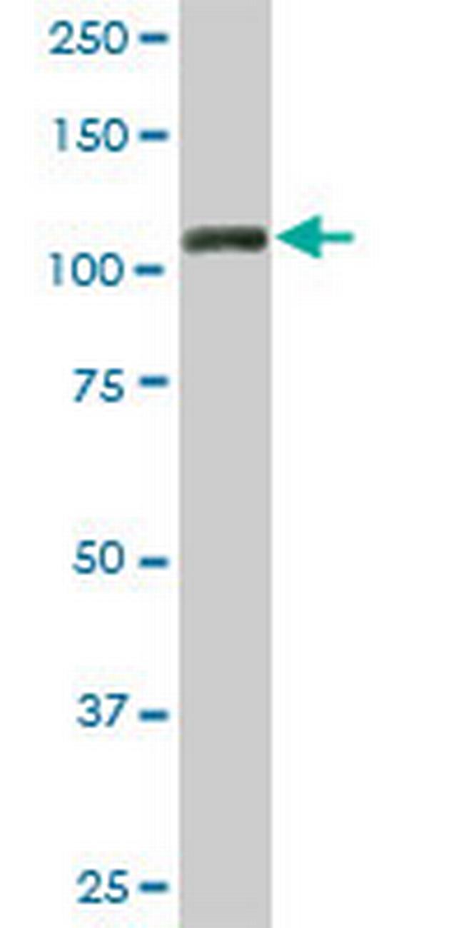 TRIM28 Antibody in Western Blot (WB)