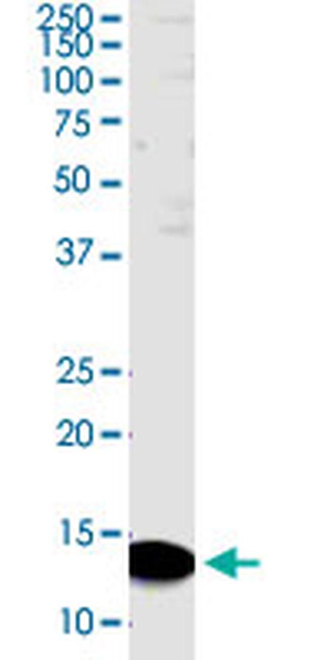 PDZK1IP1 Antibody in Western Blot (WB)