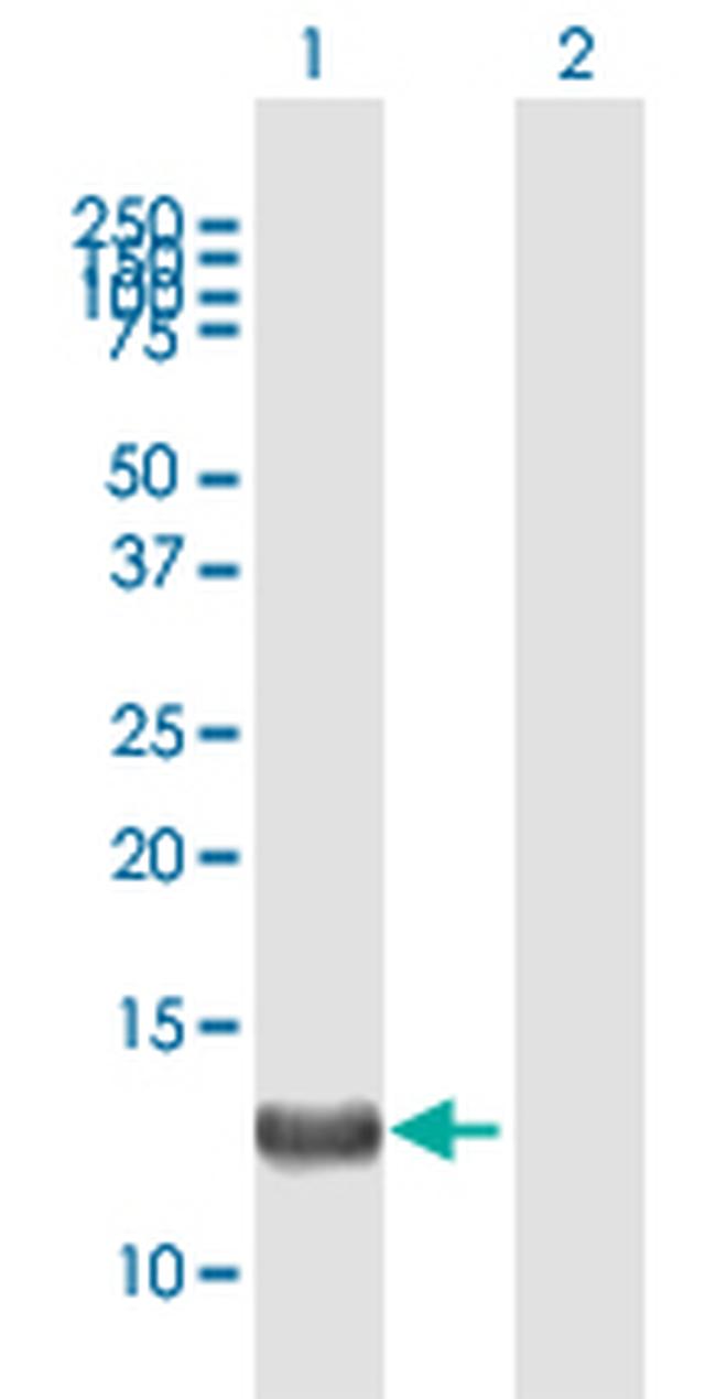 FARP1 Antibody in Western Blot (WB)