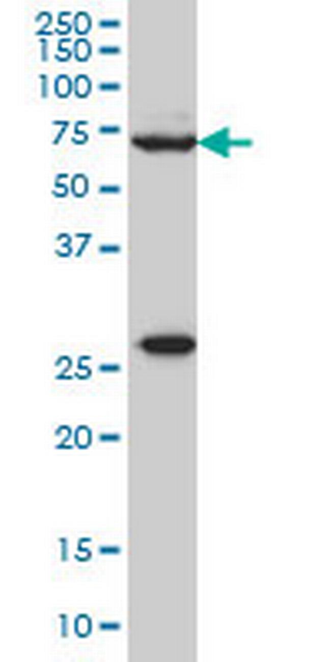 WASF2 Antibody in Western Blot (WB)