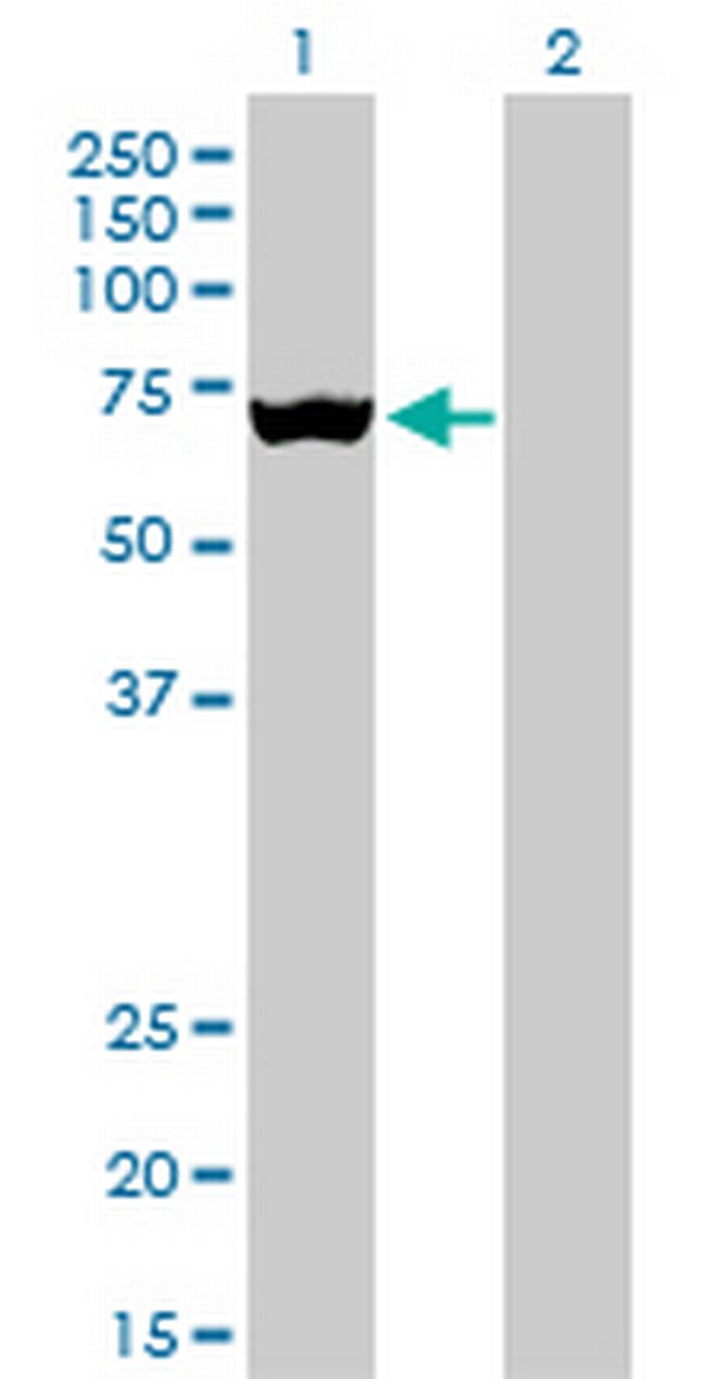 SLC25A13 Antibody in Western Blot (WB)