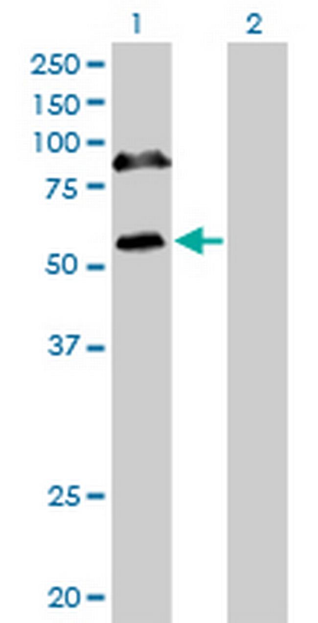 RBM6 Antibody in Western Blot (WB)
