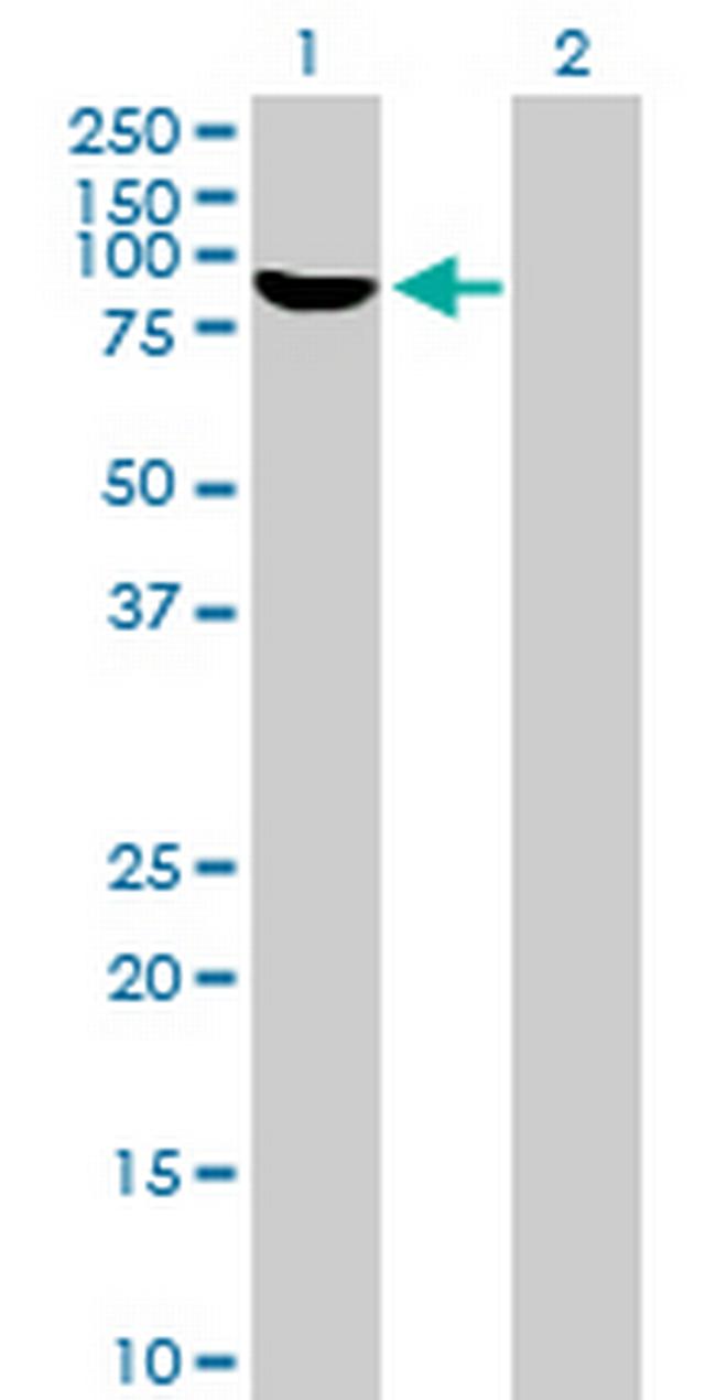 RBM5 Antibody in Western Blot (WB)