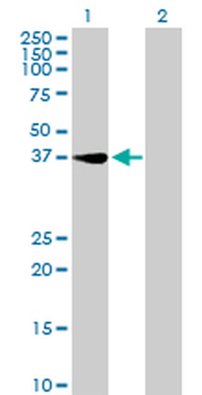 RNF41 Antibody in Western Blot (WB)