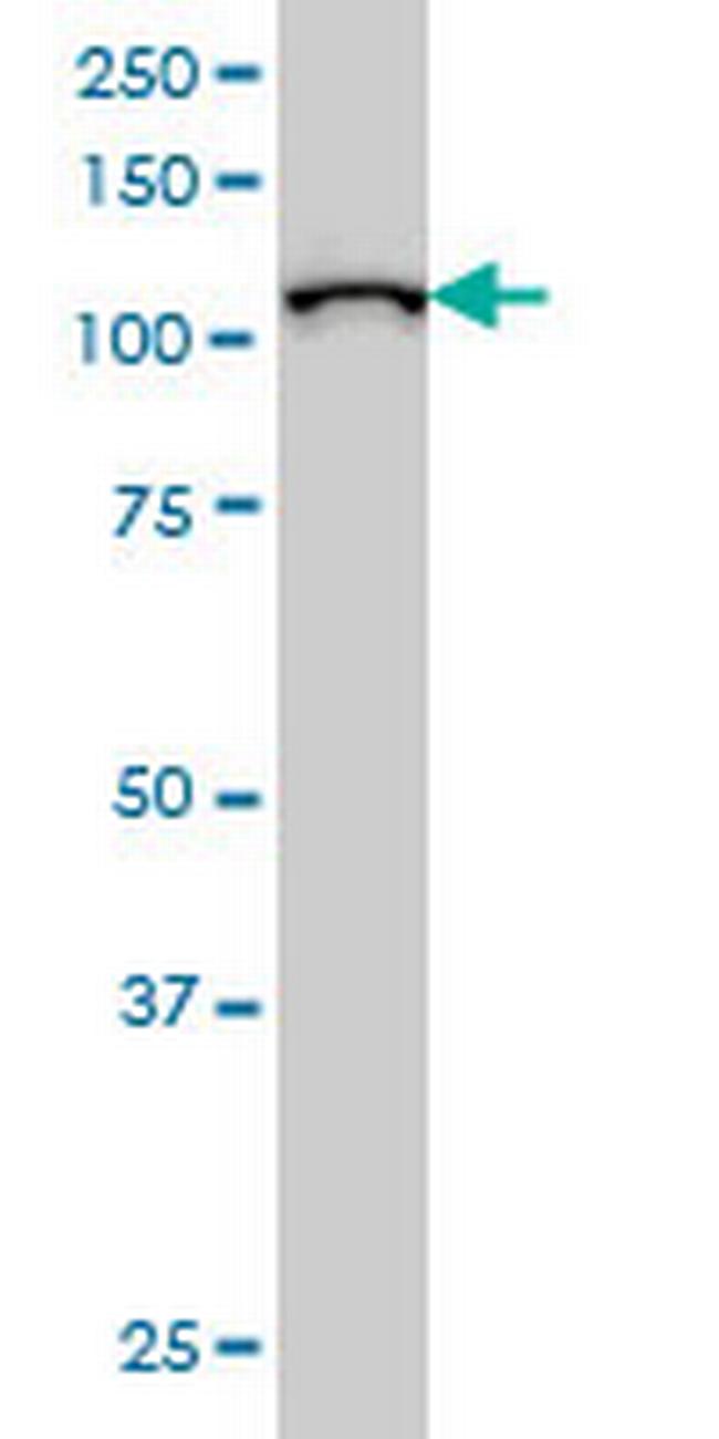 MPHOSPH10 Antibody in Western Blot (WB)