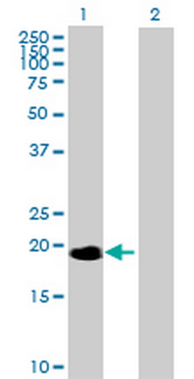 NME6 Antibody in Western Blot (WB)