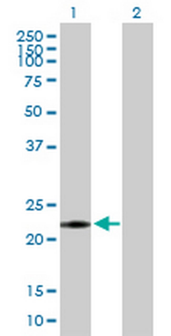 NME6 Antibody in Western Blot (WB)