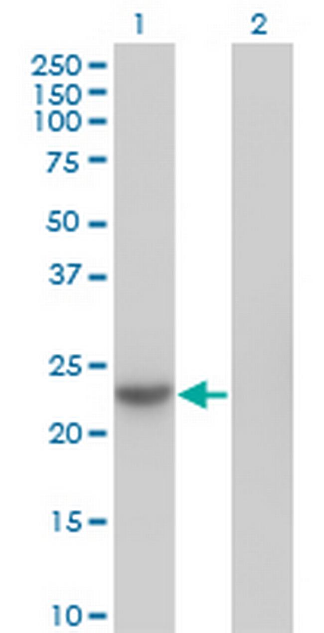 NME6 Antibody in Western Blot (WB)