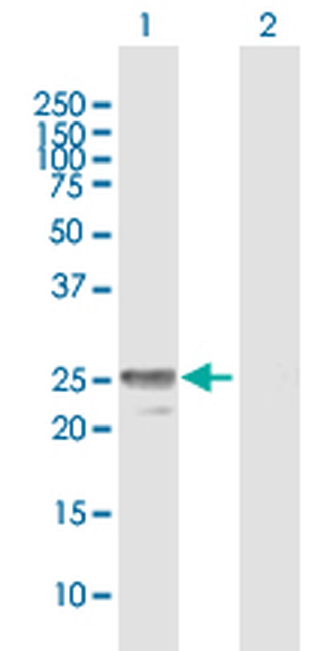MPZL2 Antibody in Western Blot (WB)