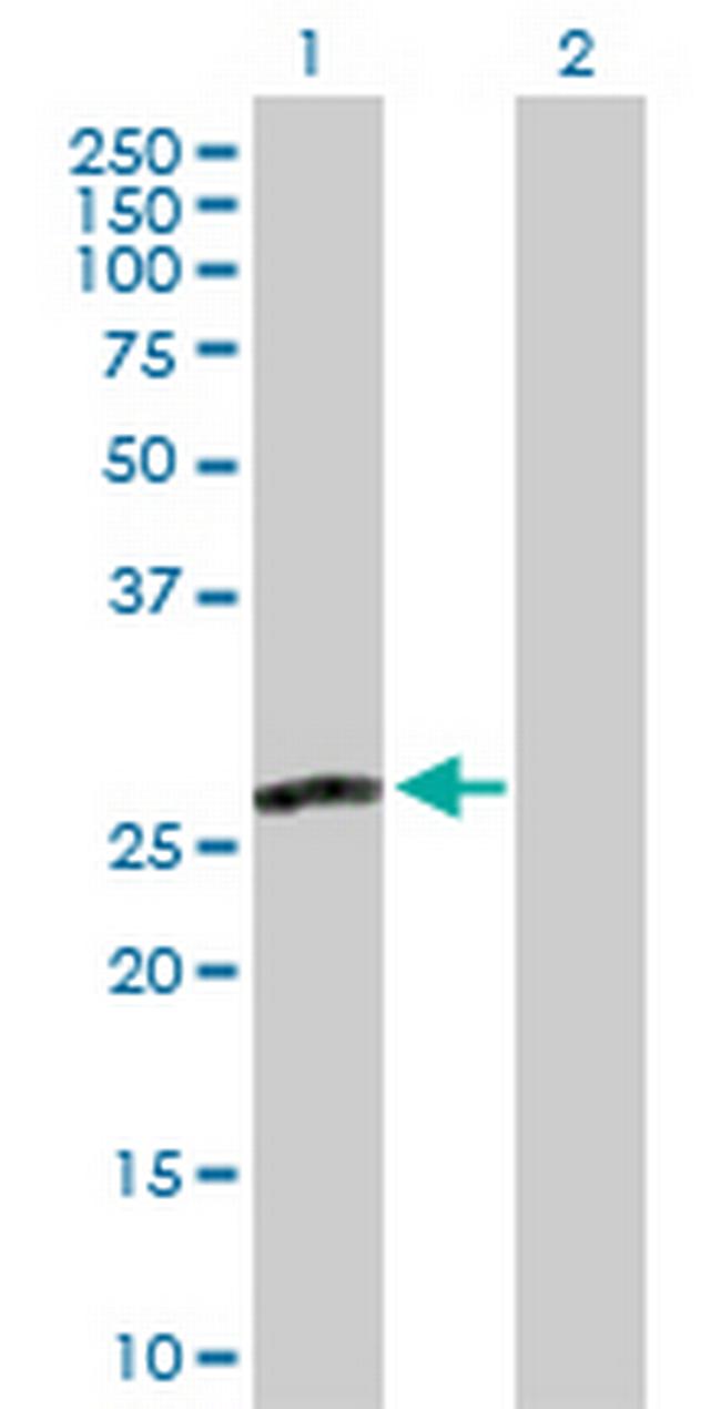 MPZL2 Antibody in Western Blot (WB)