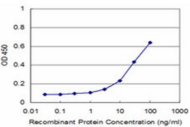 TOPORS Antibody in ELISA (ELISA)