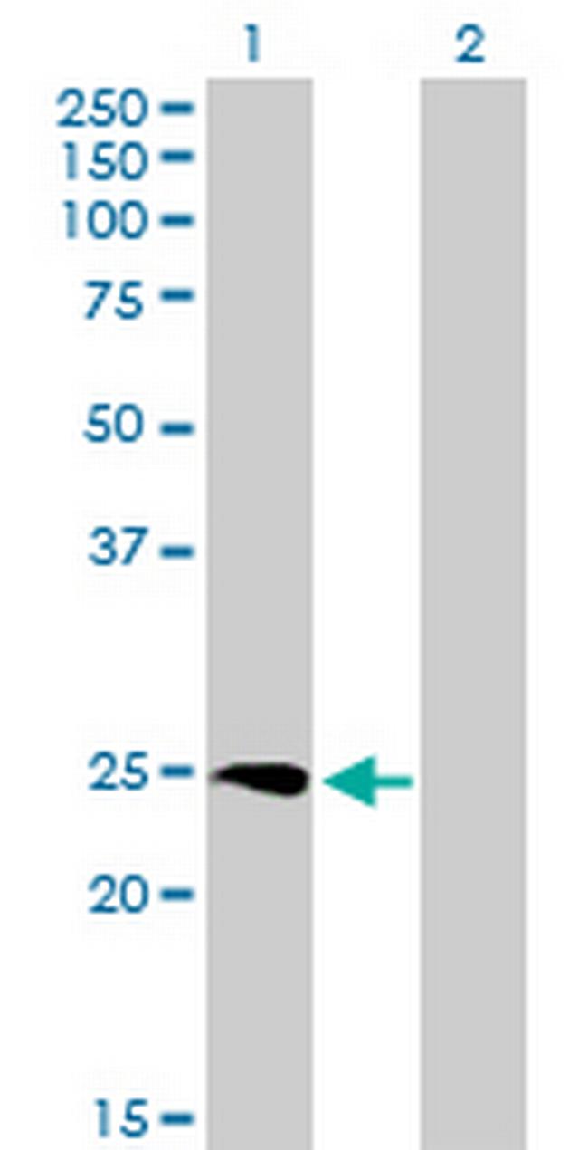 SSX3 Antibody in Western Blot (WB)