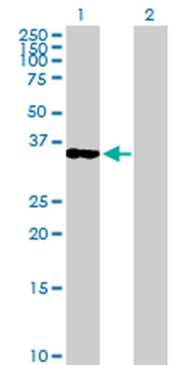 OLIG2 Antibody in Western Blot (WB)