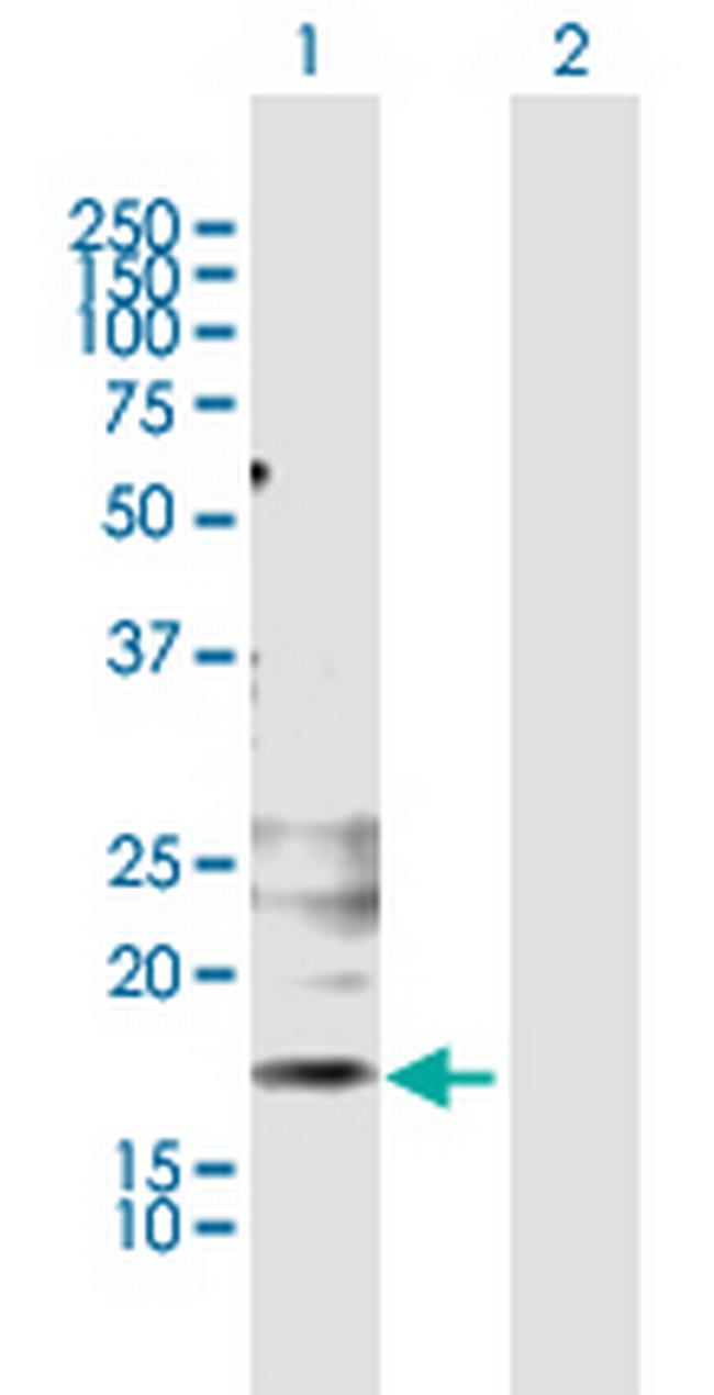 KLRG1 Antibody in Western Blot (WB)