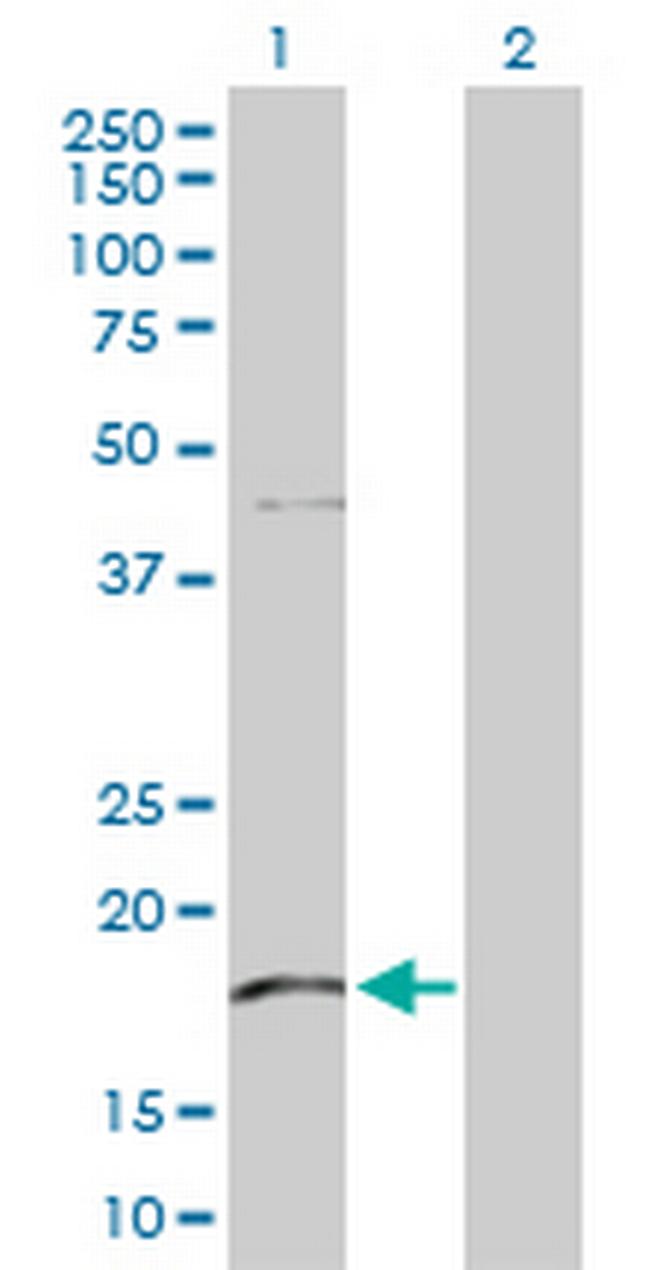 KLRG1 Antibody in Western Blot (WB)