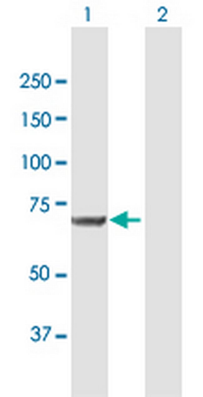 MSLN Antibody in Western Blot (WB)