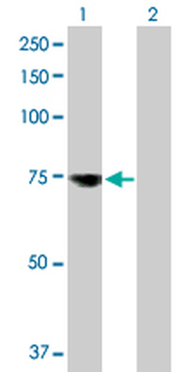 MSLN Antibody in Western Blot (WB)