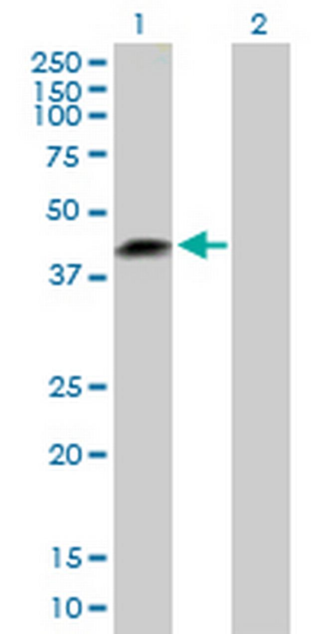 LRRC23 Antibody in Western Blot (WB)