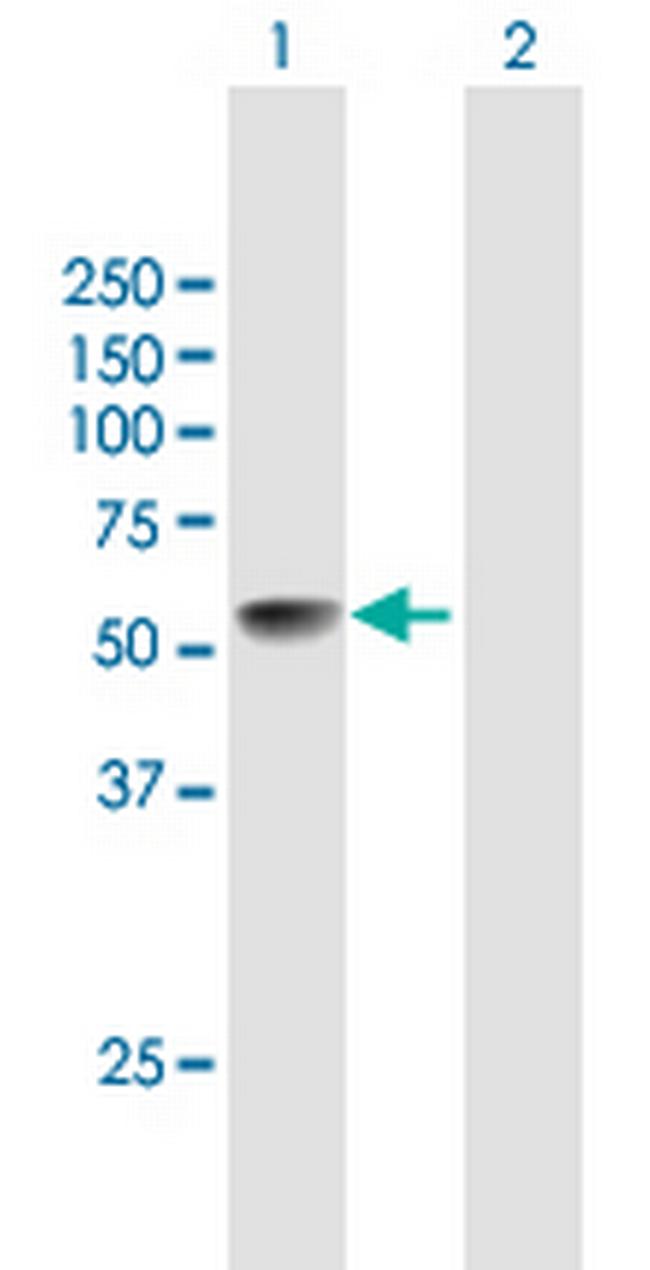 LRRC17 Antibody in Western Blot (WB)