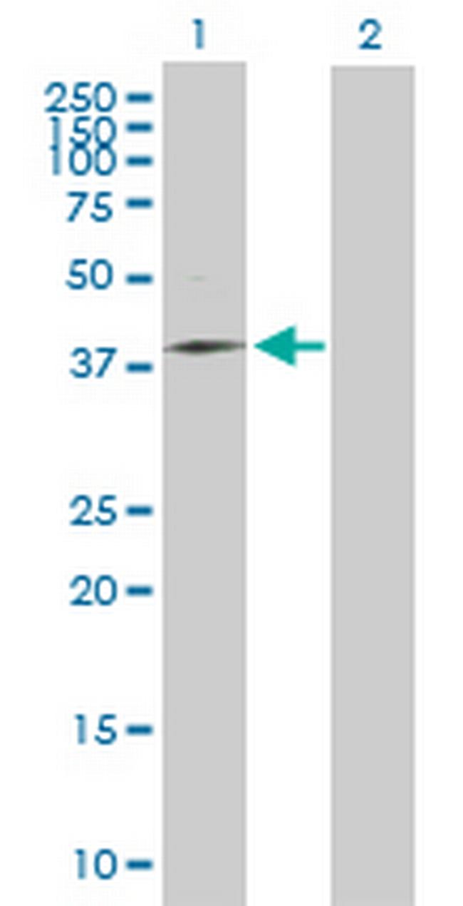 MRPS31 Antibody in Western Blot (WB)