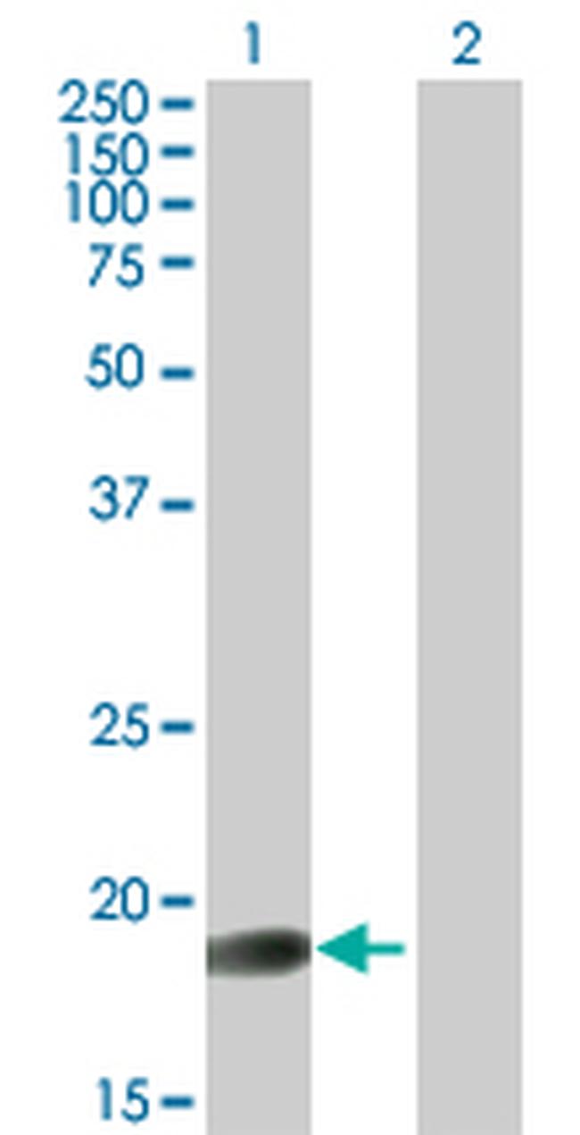 GLYAT Antibody in Western Blot (WB)