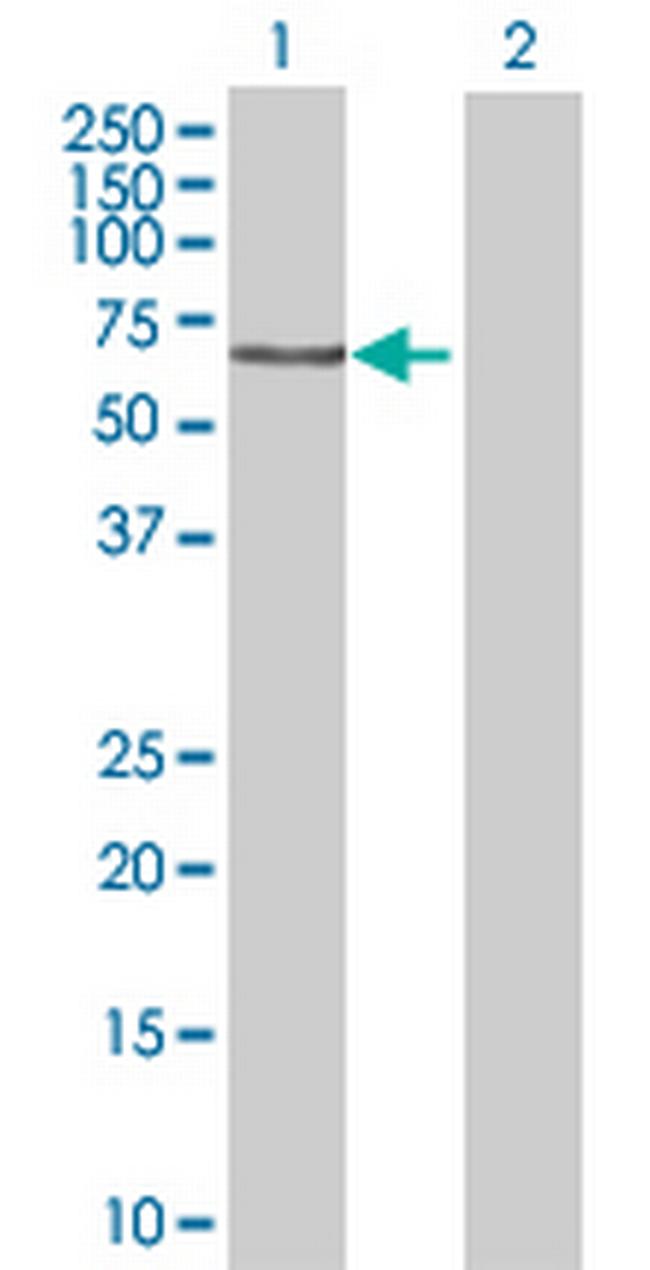 STAM2 Antibody in Western Blot (WB)